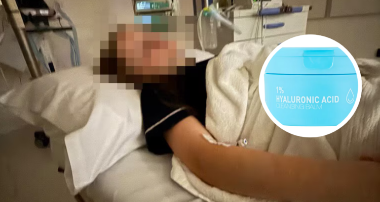 Mascarilla con ácido hialurónico provoca lesión ocular a niña en Australia: empresa retiró producto del mercado