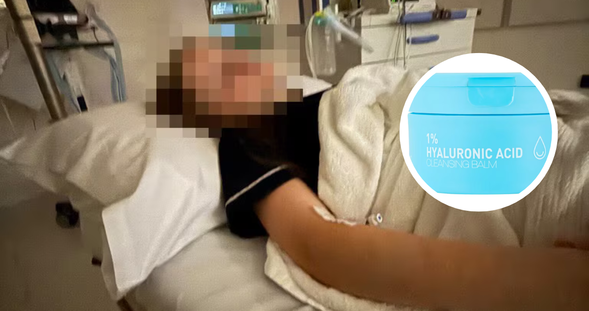 Mascarilla con ácido hialurónico provoca lesión ocular a niña en Australia: empresa retiró producto del mercado