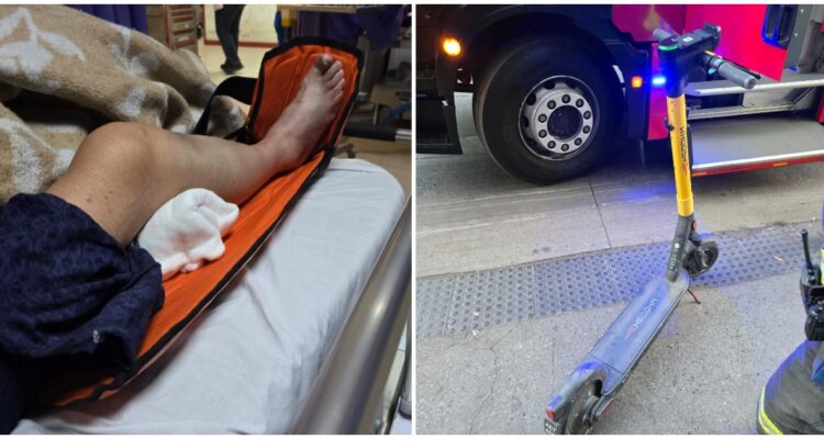Mujer atropellada por scooter en Concepción