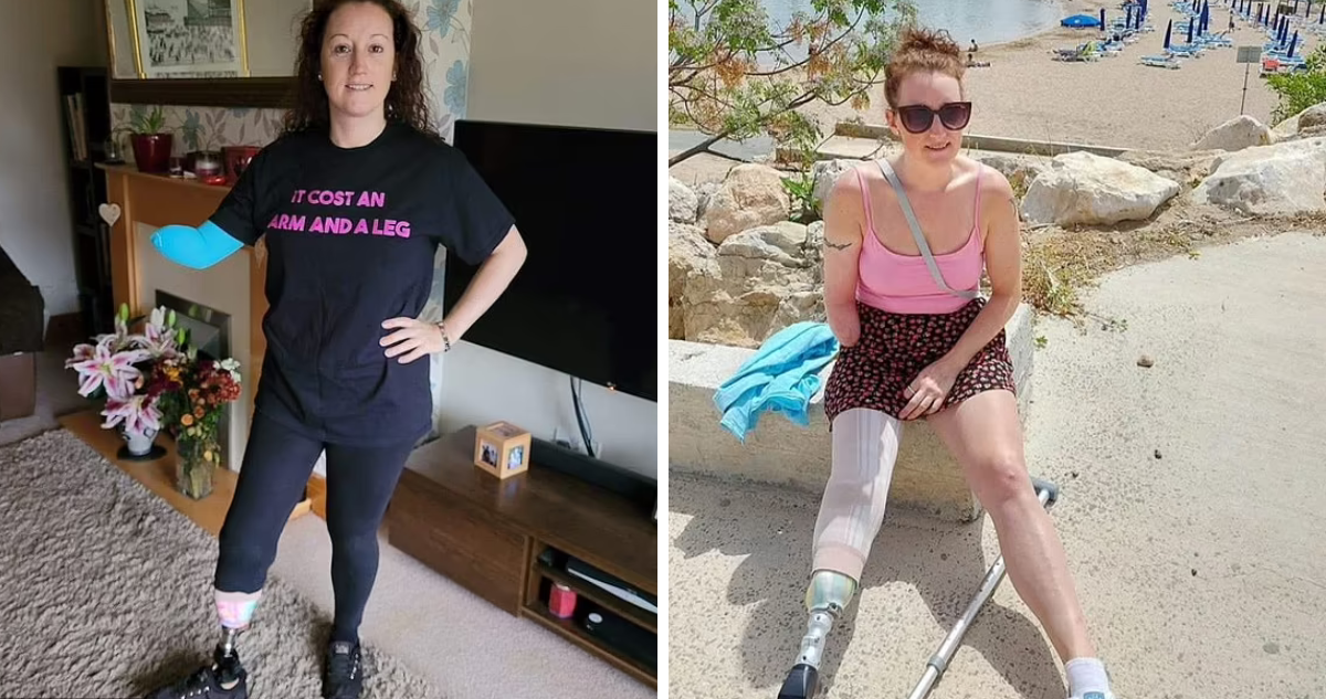 Británica sufrió la amputación de sus extremidades luego de leves golpes: padece rara enfermedad
