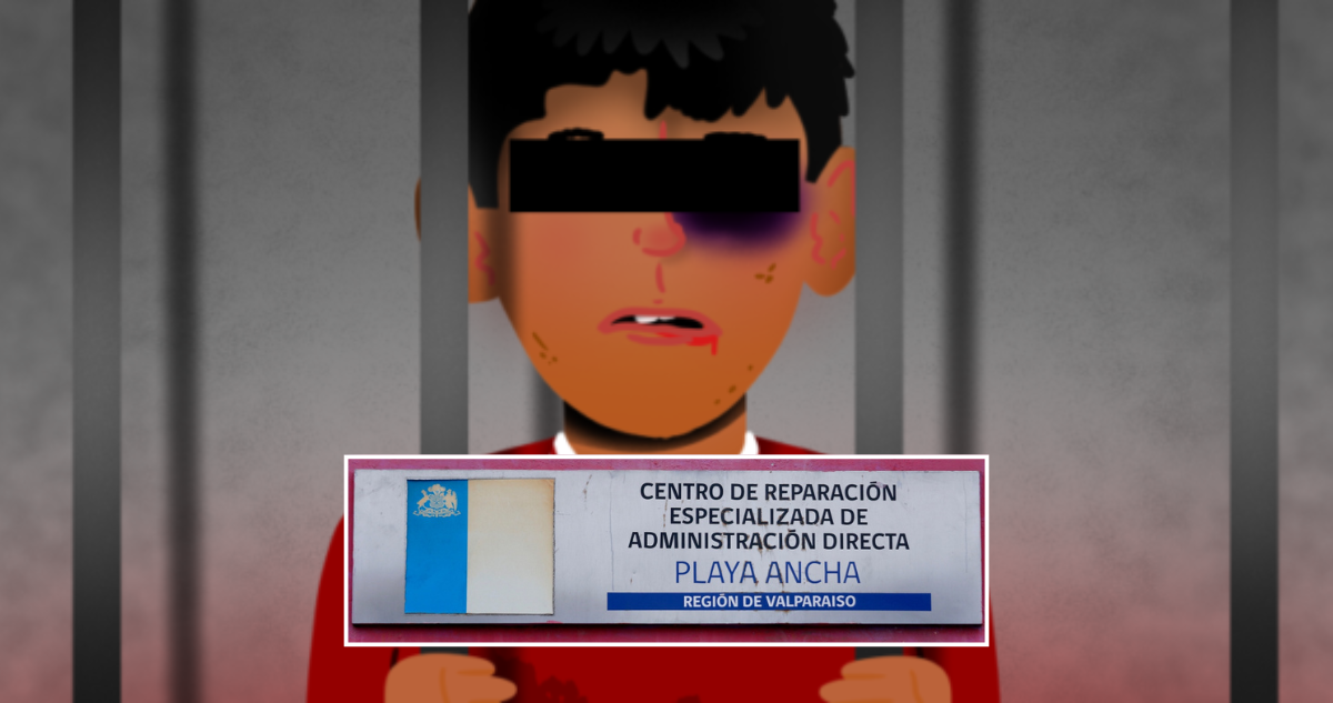 Suspensión condicional de 8 profesionales de Cread de Playa Ancha