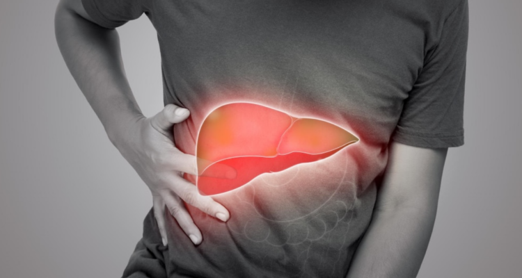 Hígado graso en Chile