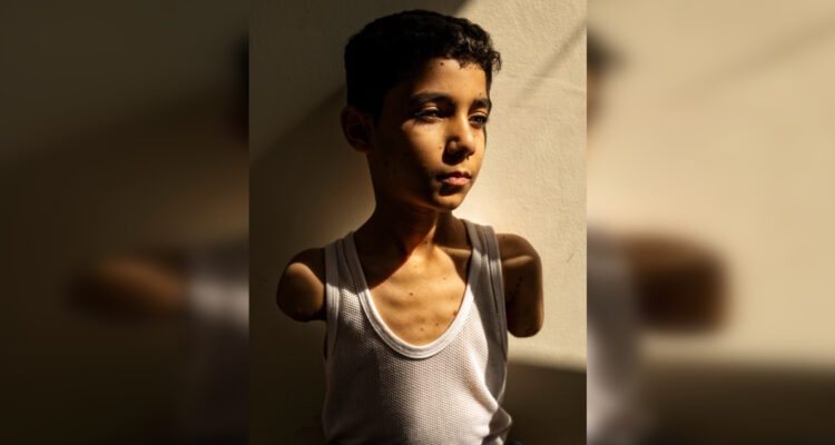 Imagen de un niño palestino mutilado en Gaza es elegida Foto del Año del World Press Photo