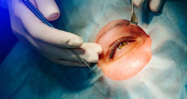 Paciente quedó ciega tras cirugía de cataratas: Suprema confirma indemnización de $250 millones