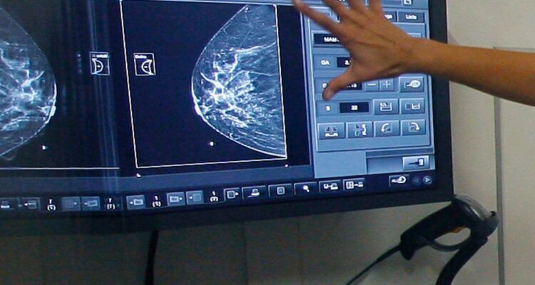 Mantienen prisión preventiva a imputados por entregar mamografías falsas en centro médico de Concepción