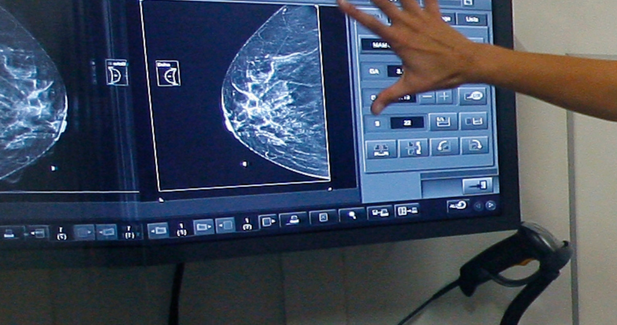 Mantienen prisión preventiva a imputados por entregar mamografías falsas en centro médico de Concepción