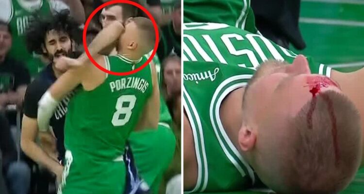 El impresionante codazo que dejó a Porzingis completamente ensangrentado en el Celtics vs Magic de la NBA
