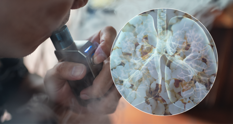 Pulmón de palomitas de maíz: esto te podría pasar si consumes cigarros electrónicos en exceso