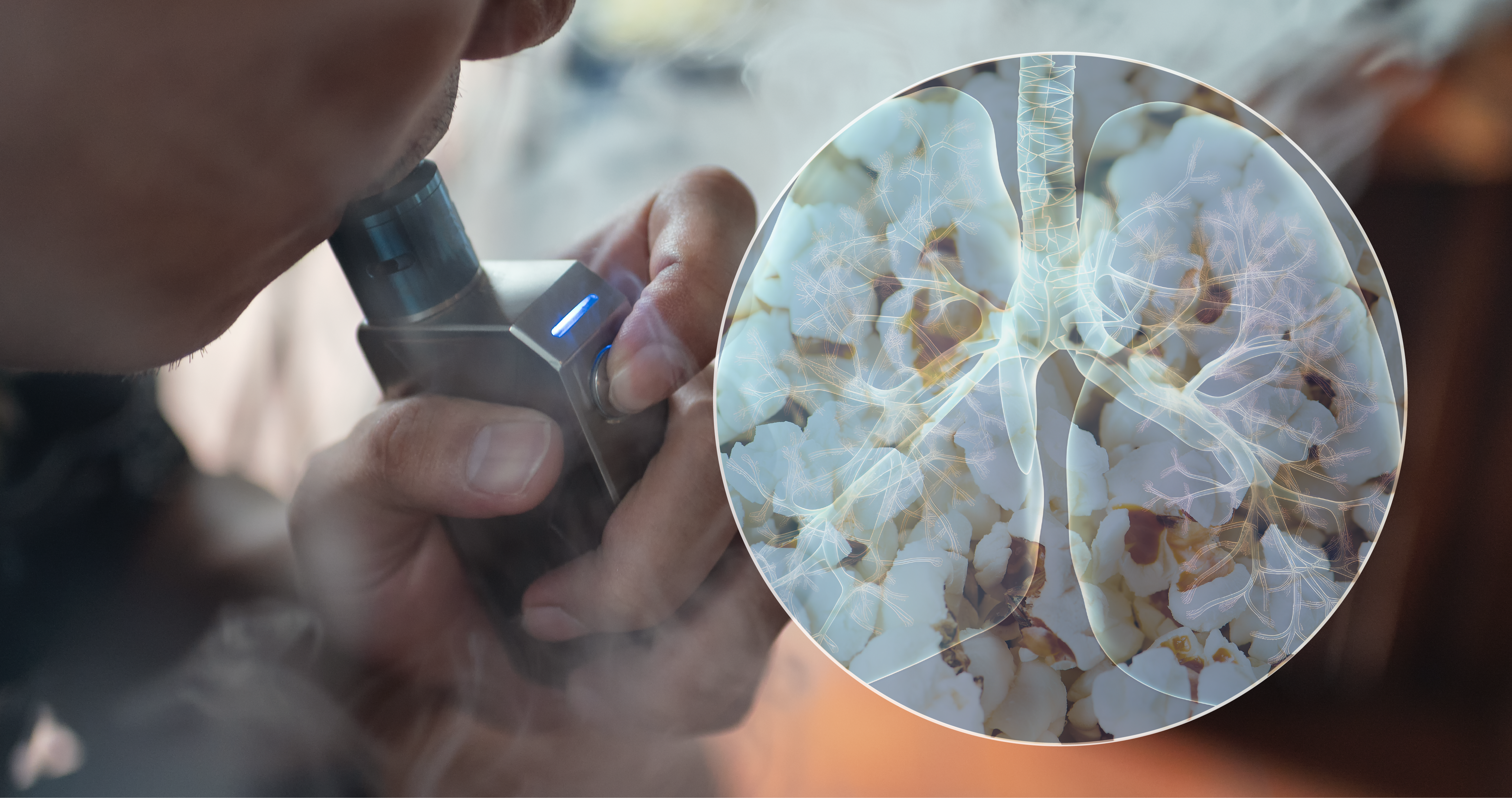 Pulmón de palomitas de maíz: esto te podría pasar si consumes cigarros electrónicos en exceso