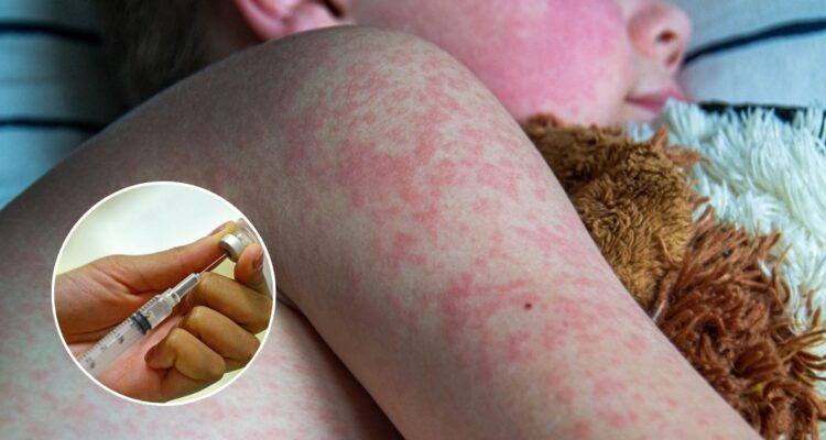 Universidad Johns Hopkins