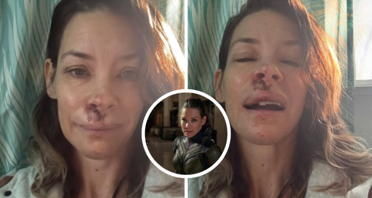 Actriz Evangeline Lilly de Lost y Ant-Man, sufrió fuerte caída en una playa: casi perdió un diente
