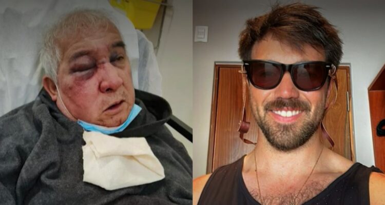 Sujeto propina brutal golpiza a conserje (70) en Vitacura: víctima podría perder un ojo