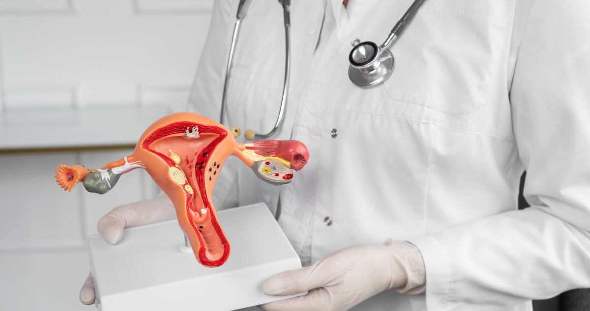 Síntomas y factores de riesgo del cáncer de ovario: es la segunda enfermedad ginecológica más común