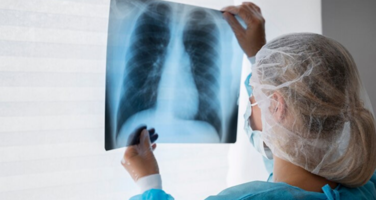 Físico chileno participa en estudio que descubrió “células mutantes” que originarían cáncer de pulmón