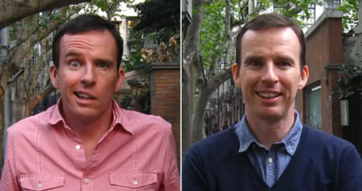 Caso de parálisis de bell