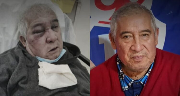 “Era más grave de lo que decían”: el devastador diagnóstico de conserje golpeado en Vitacura