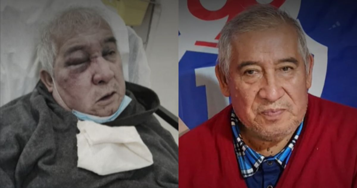 “Era más grave de lo que decían”: el devastador diagnóstico de conserje golpeado en Vitacura