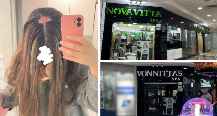 Peluquería arremete judicialmente contra mujer que denunció graves quemaduras que la dejaron sin pelo