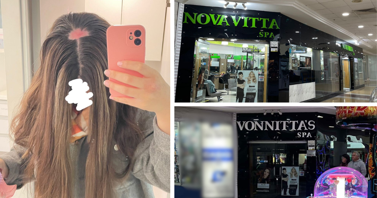 Peluquería arremete judicialmente contra mujer que denunció graves quemaduras que la dejaron sin pelo