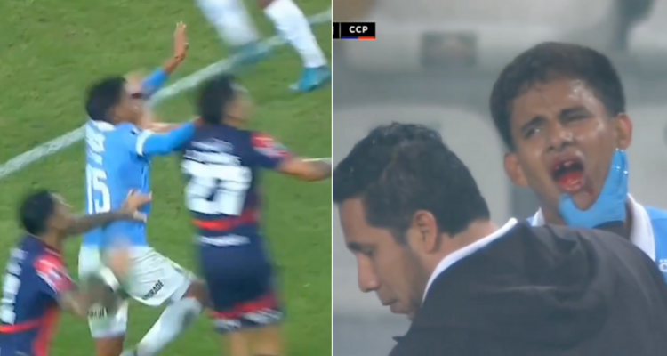 Violenta entrada le voló un diente a jugador de Sporting Cristal en Copa Libertadores.