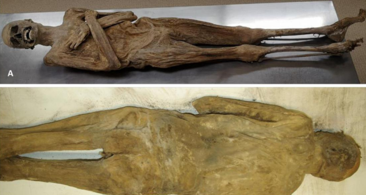 Experto descubren que momia fue embalsamada a través del recto, un método desconocido hasta la fecha