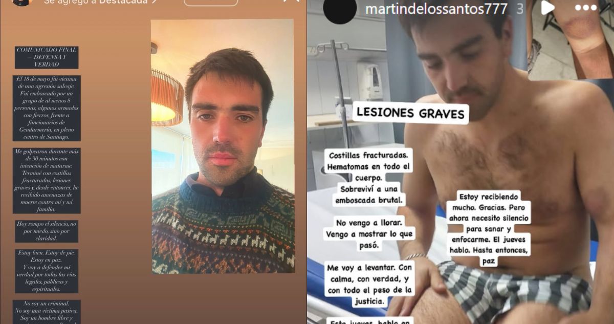 Sin hablar de la agresión: la inconexa defensa del acusado por brutal golpiza a conserje