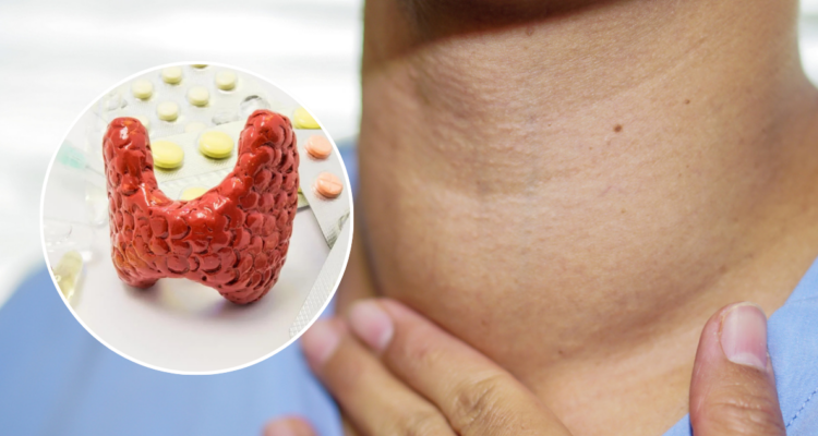 Cuidado con la automedicación: cómo algunos fármacos pueden afectar tu tiroides