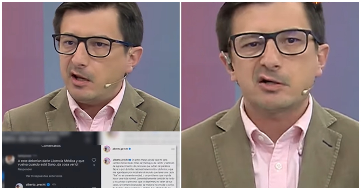 Alberto Precht y críticas por trabajar con parálisis facial: “Mi cabeza y mi corazón están intactos”