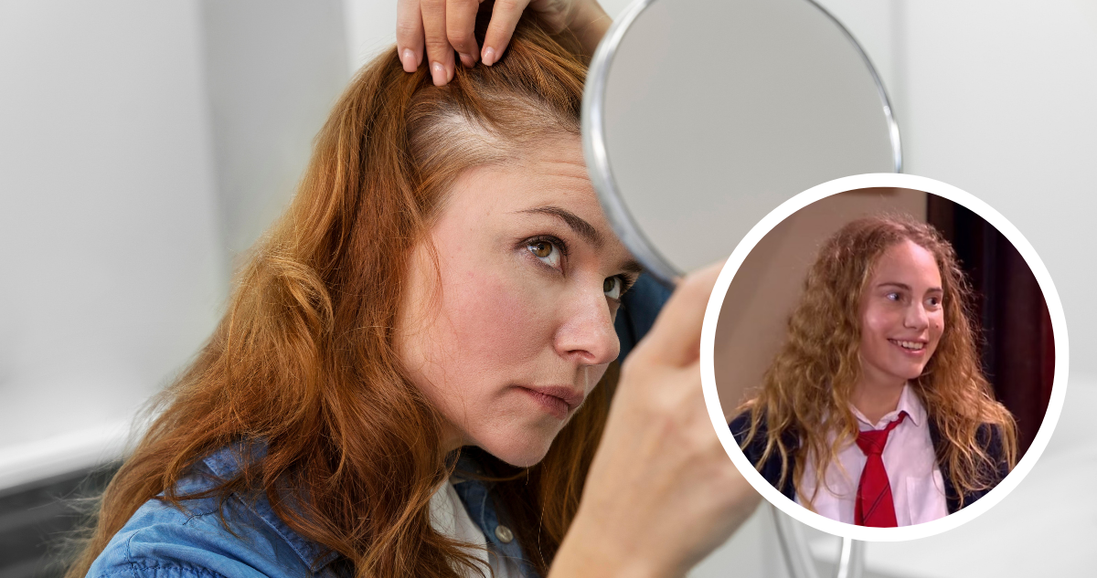 Alopecia: la condición que padece la actriz Li Fridman y que sería cada vez más común en mujeres