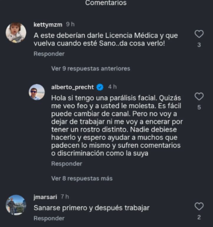 Alberto Precht y críticas por trabajar con parálisis facial: "Mi cabeza y mi corazón están intactos"