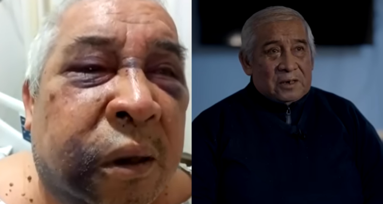 Conserje relata golpiza sufrida en Vitacura: familia exige cárcel para el agresor