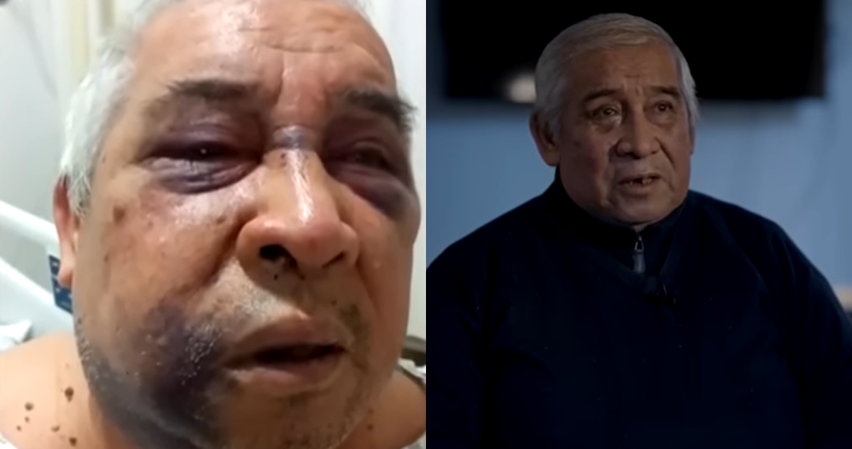Conserje relata golpiza sufrida en Vitacura: familia exige cárcel para el agresor