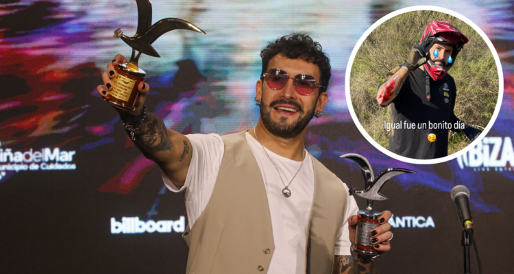 Edo Caroe en el Festival de Viña y en reciente Instagram Storie