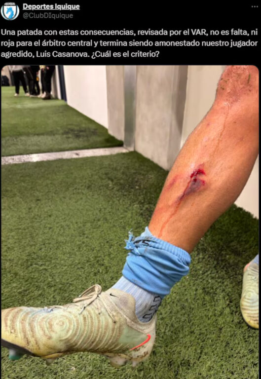 El reclamo de Iquique contra arbitraje en duelo ante Everton