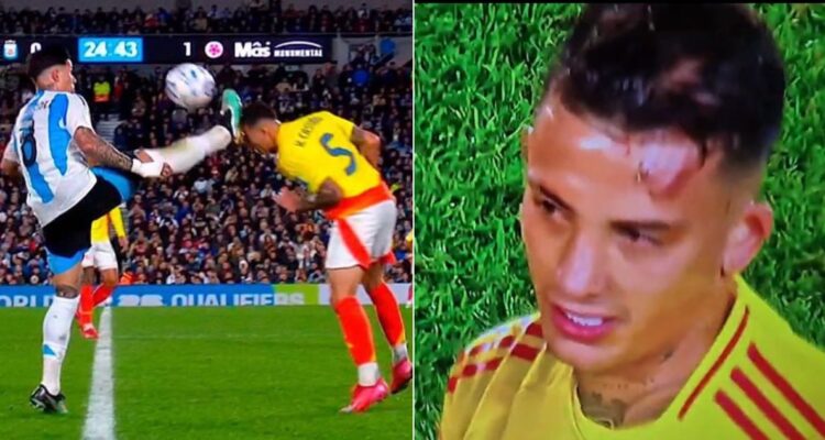 El patadón de Enzo Fernández en la cabeza que le costó expulsión ante Colombia: rostro de Kevin Castaño quedó ‘marcado’