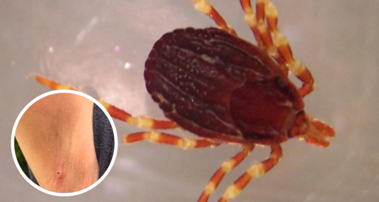 Garrapatas que muerden a humanos