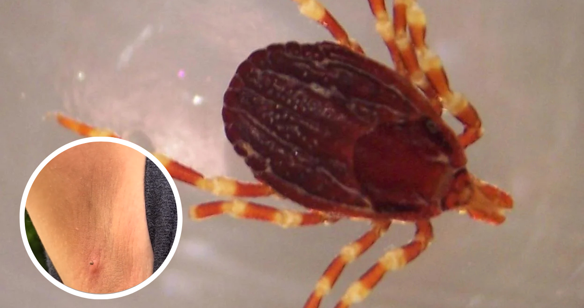 Garrapatas que muerden a humanos
