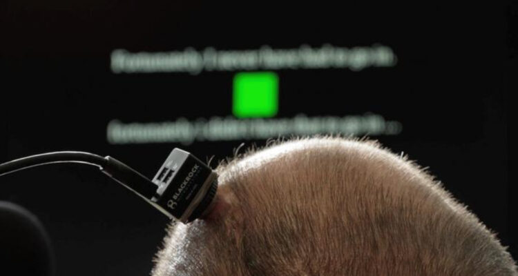 Crean nueva interfaz cerebro-computadora que permitió a paciente con ELA hablar, entonar y cantar
