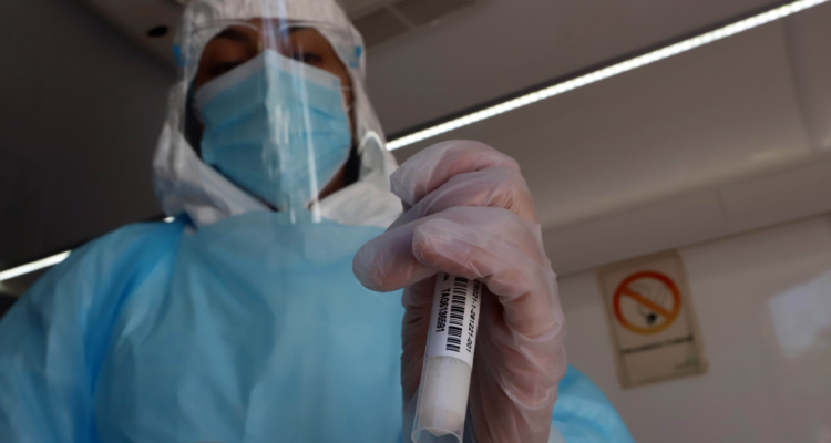 NB.1.8.1: la nueva variante covid más contagiosa pero menos mortal que podría llegar a Chile