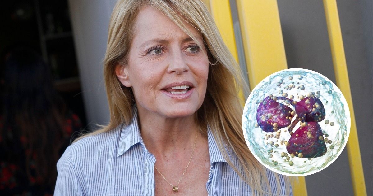 Neutropenia: qué es y cuáles son los síntomas de la enfermedad de Cecilia Bolocco