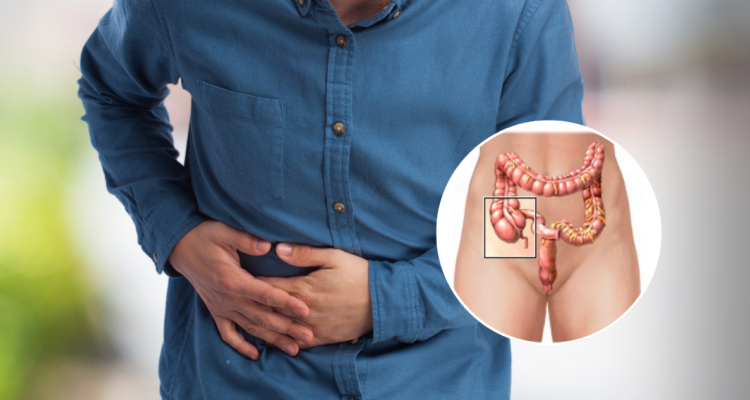 Cáncer de apéndice