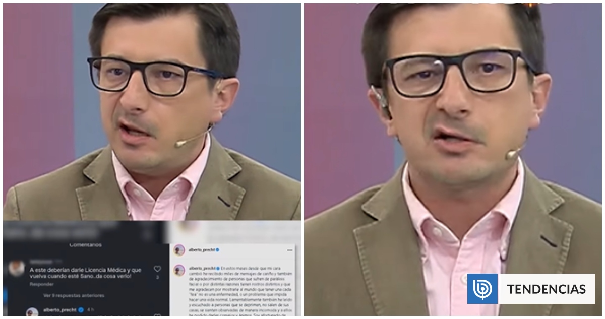 Alberto Precht y críticas por trabajar con parálisis facial: 