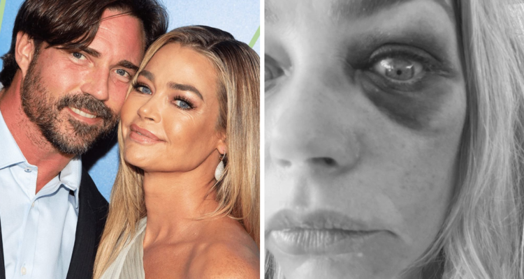 Denise Richards junto a su exesposo, Aaron Phypers, a quien acusa de haberla golpeado