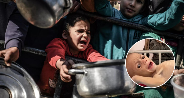 Al menos 21 niños han muerto de hambre en las últimas 72 horas en Gaza, según reportes