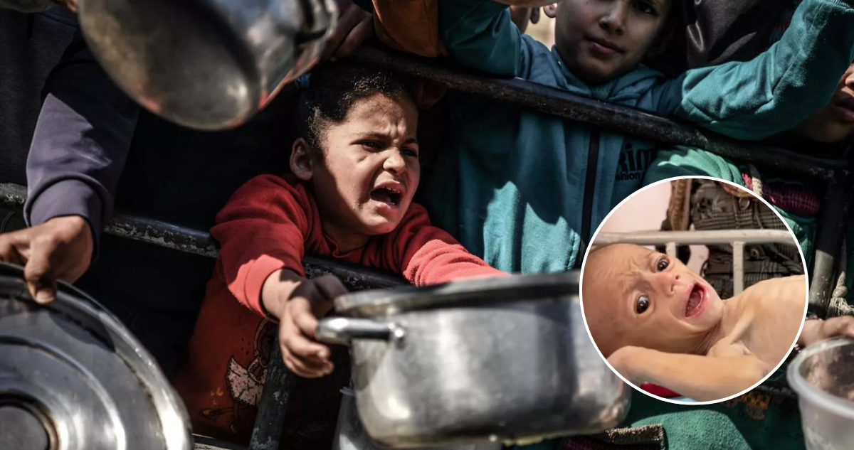 Al menos 21 niños han muerto de hambre en las últimas 72 horas en Gaza, según reportes