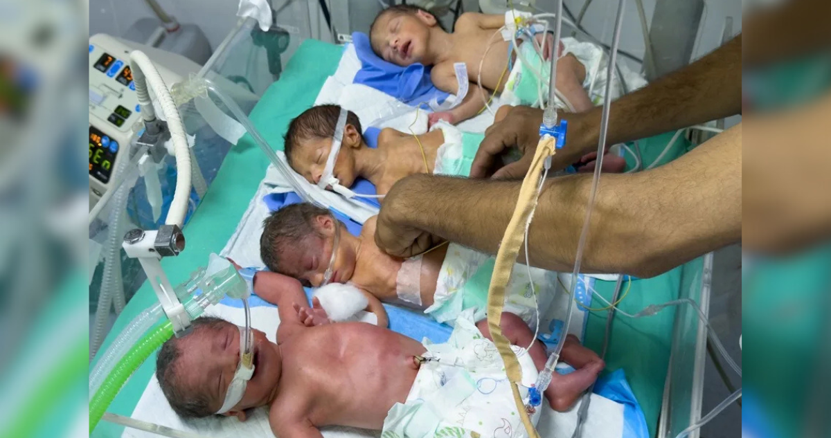 Crisis de hambruna en Gaza: bebés con malnutrición en una sola incubadora