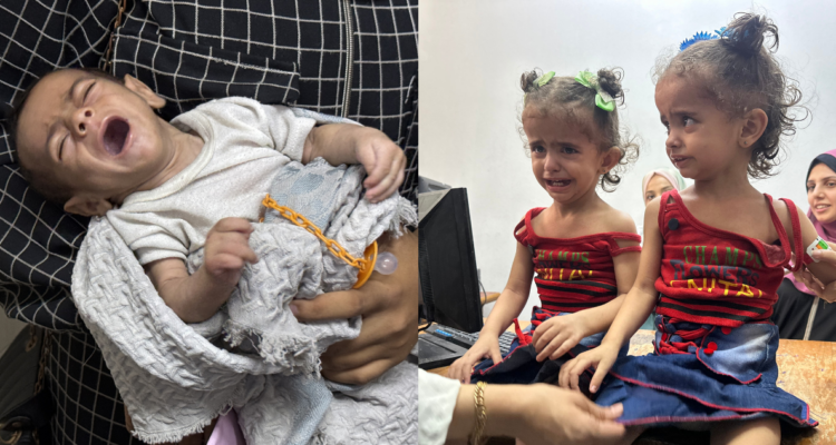 Crisis de hambruna en Gaza: reportan 10 nuevas muertes por desnutrición en las últimas 24 horas