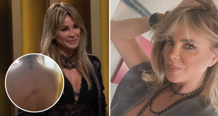 “Me sentí aterrorizada”: Eva Gómez cuenta cómo lo pasó tras enterarse que tenía un melanoma