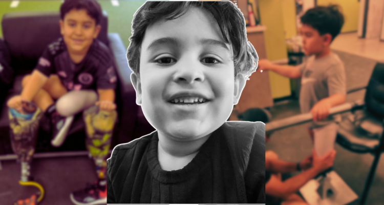 Padres buscan justicia para su hijo atropellado por micro en Santiago: terminó con pierna amputada