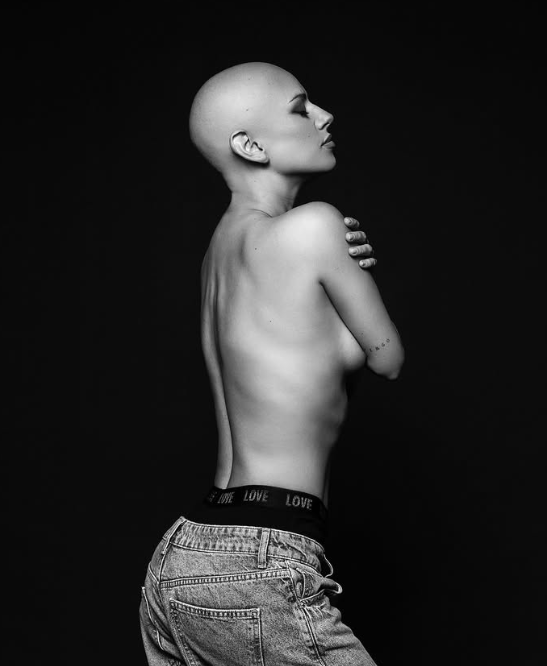 A ti cuerpo mío GRACIAS 🙏
Has soportado 6 quimioterapias y aunque a veces siento que no podrás con 2 más, aquí estás. Sigues respirando, sigues latiendo, sigues dándome espacio para vivir, sentir y sanar.
Solo tú sabes cuántas veces he querido rendirme y he pensado que este tratamiento, que debería curarme, también me está enfermando. Pero insistes en recordarme que aún queda fuerza.

Hoy me muestro en esta foto: hermosa, más flaca y calva, porque me niego a esconderme. Porque cada cicatriz, cada célula cansada, cada parte que ya no es como antes, merece respeto y amor.

Y a las mujeres que me siguen y me dicen que las inspiro, hoy les hablo desde mi oscuridad, donde se lucha llorando, pero siempre digna. Desde donde aún se elige el amor propio, aunque duele por estar a medias. Pero mis washitas, no siempre hay que ser fuertes, a veces solo basta con seguir hasta el final 💪🏼 aunque estemos rotas, cansadas y cagás de miedo, seguimos siendo luz!  Somos la belleza real 